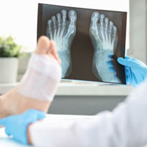 Digital X-Ray