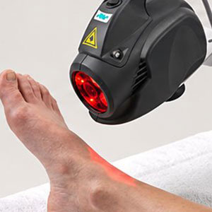 MLS Laser
