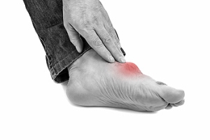 What Is Gout?