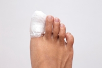 Exercising a Broken Toe That Has Healed
